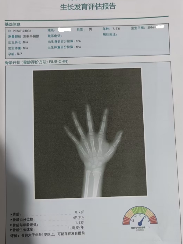 骨齡和身高有什么關系？每個孩子都有必要檢測嗎？